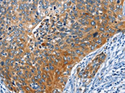 STK17B Antibody