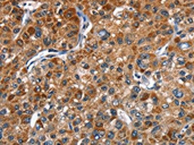 STK17B Antibody