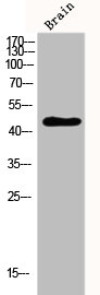 STK17B antibody