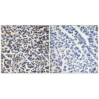 STK17B Antibody