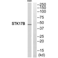STK17B antibody