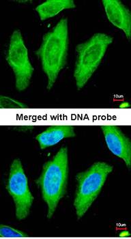 STK24 antibody