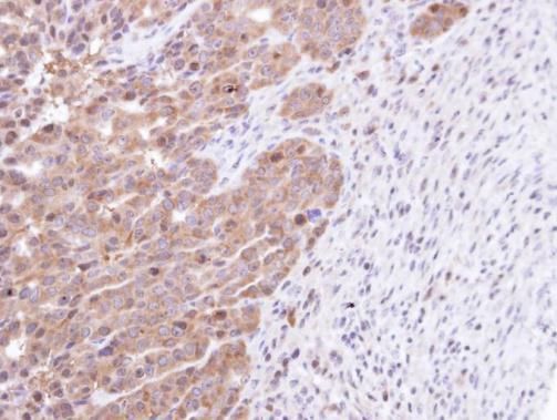 STK25 antibody [N1C1]