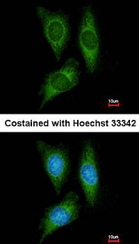 STK25 antibody