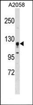 STK31 antibody