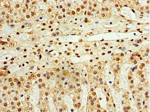 STK32A Antibody