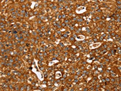 STK32A Antibody
