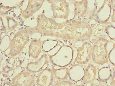 STK33 Antibody