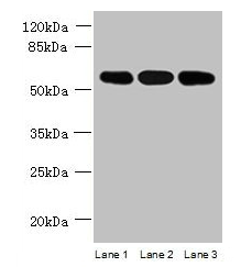 STK33 Antibody