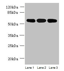 STK33 antibody