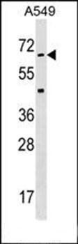 STK35 antibody