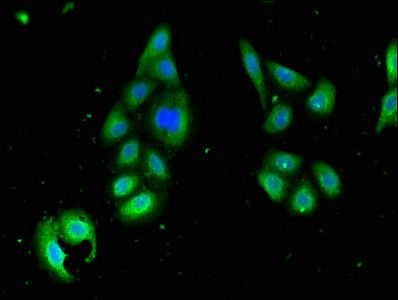 STK35 antibody