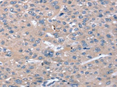 STK36 Antibody