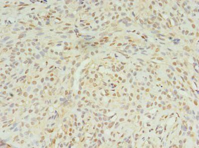 STK38L Antibody