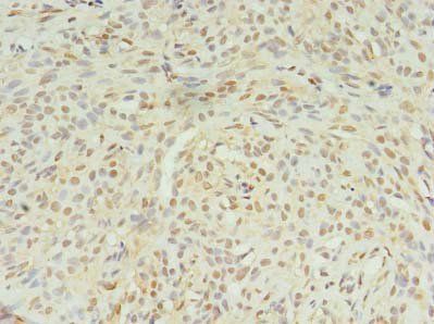 STK38L antibody