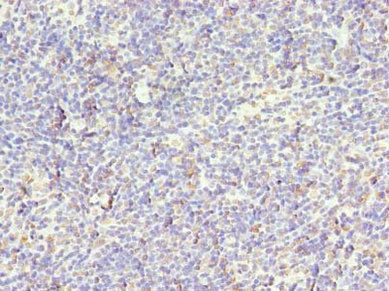 STK38L antibody