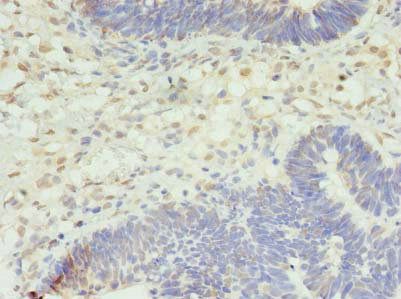 STK38L Antibody