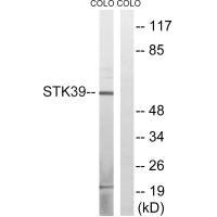 STK39 (Ab-311) antibody