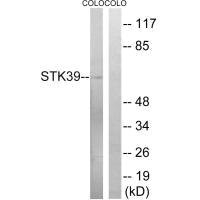 STK39 (Ab-325) antibody