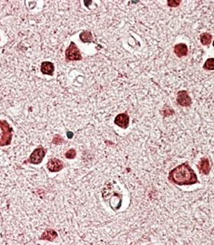 Goat anti-STK39 / SPAK Antibody