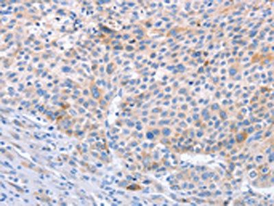 STK4 Antibody