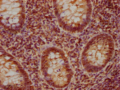 STK4 Antibody