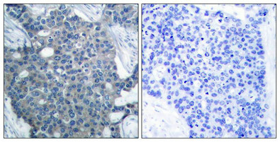 STMN1 (Ab-25) Antibody