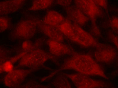 STMN1 (Ab-38) Antibody