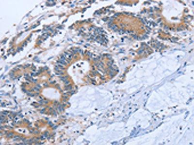 STMN1 Antibody