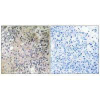 STMN1 Antibody