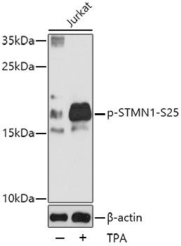 STMN1 (Phospho-S25) antibody
