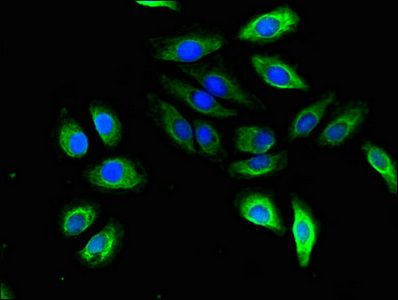 STMN2 antibody