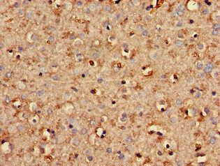 STMN2 Antibody