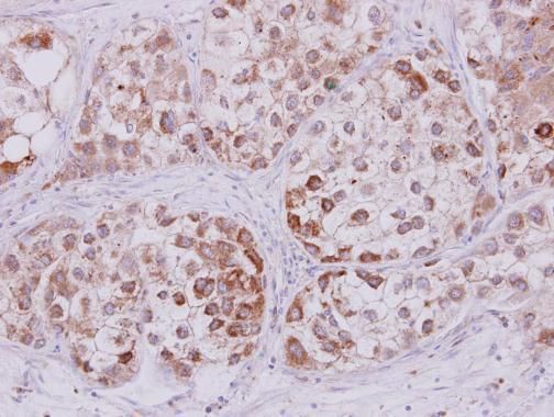 STMN2 antibody