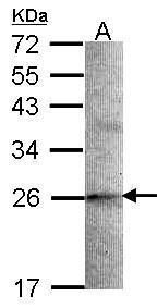 stathmin 2 Antibody