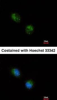 STMN2 antibody