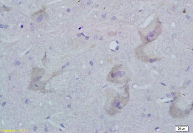 STMN3 Rabbit Polyclonal Antibody