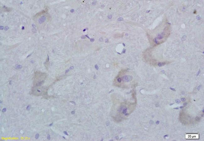 STMN3 antibody