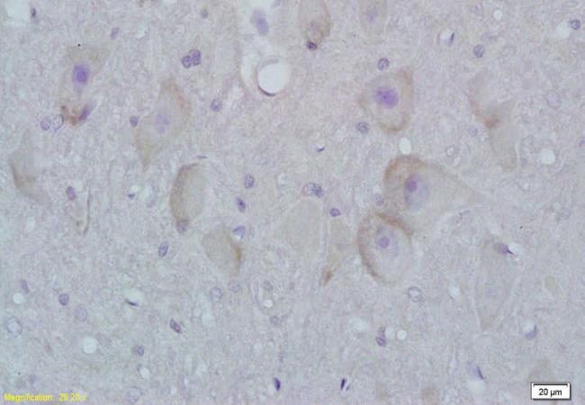 STMN3 Rabbit Polyclonal Antibody