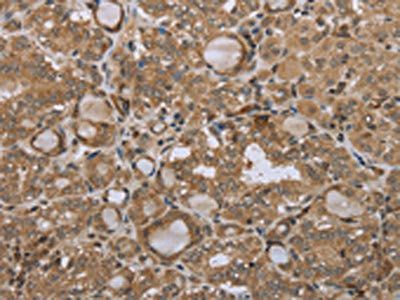 STMN2/STMN3/STMN4 Antibody