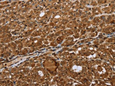 STMN2/STMN3/STMN4 Antibody