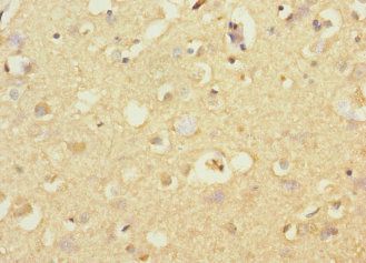 STRADA Antibody