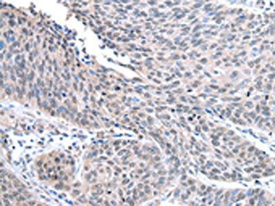 STRAP Antibody