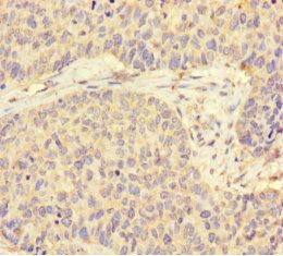 Stress-induced-phosphoprotein 1 antibody