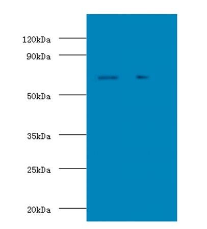 STIP1 Antibody