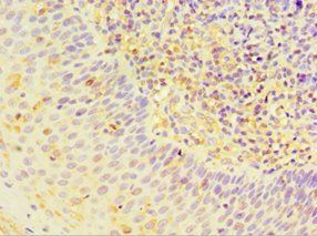 STRN antibody