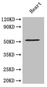 Stromelysin-2 antibody