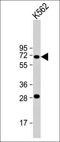 STT3A antibody