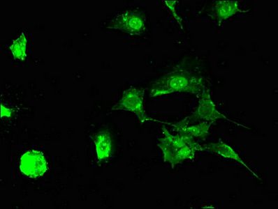 STUB1 antibody