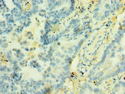STX12 Antibody